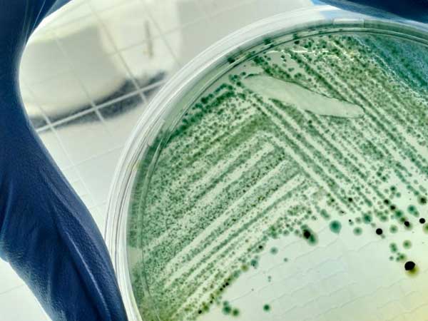 Cómo la microbiota intestinal afecta a la esperanza de vida