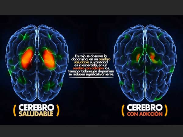 El efecto de la droga sobre el cerebro es extenso