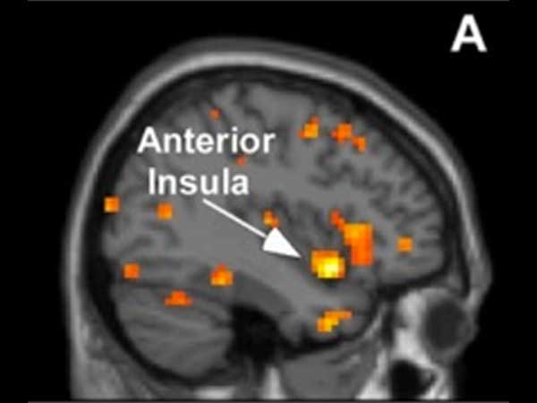 Las personas altamente sensibles tienen un cerebro más reactivo