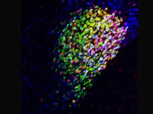 Descubren el interruptor cerebral del dolor