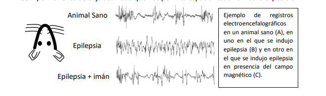 Campos magnéticos estáticos, una nueva herramienta de futuro en la epilepsia