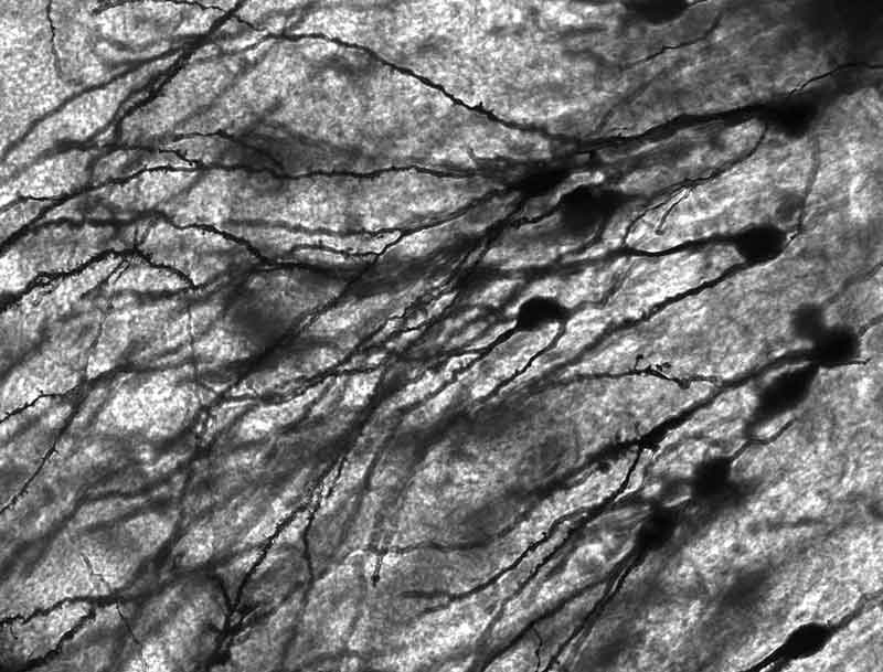Santiago Ramón y Cajal: el científico al que le debemos mucho de lo que sabemos sobre las neuronas