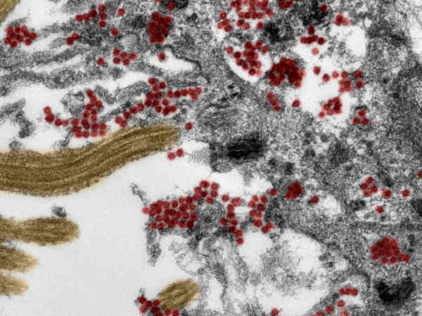 El coronavirus se cuela en el cerebro por la nariz