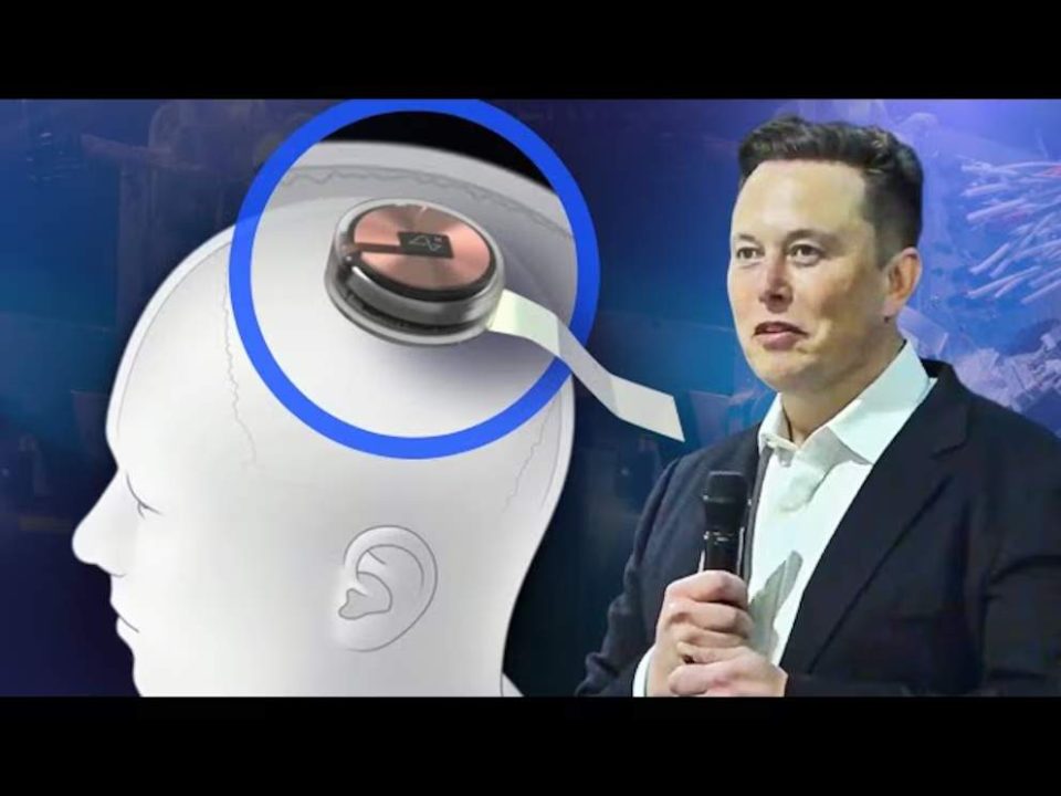 Elon Musk está detrás del exitoso desarrollo (Neuralink)