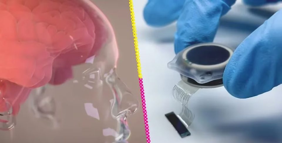 Cómo funciona el chip cerebral de Elon Musk que controla dispositivos con el pensamiento